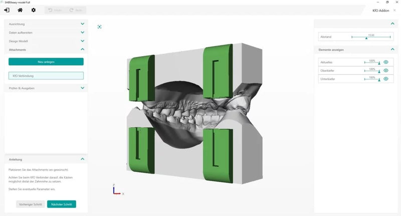 Add-On Orthodontics