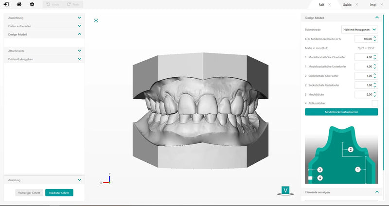Add-On Orthodontics