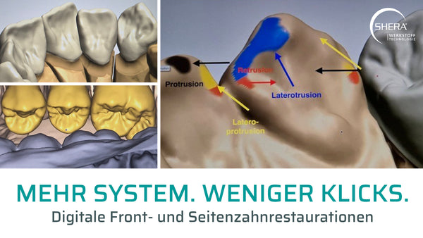 Mehr System weniger Klicks